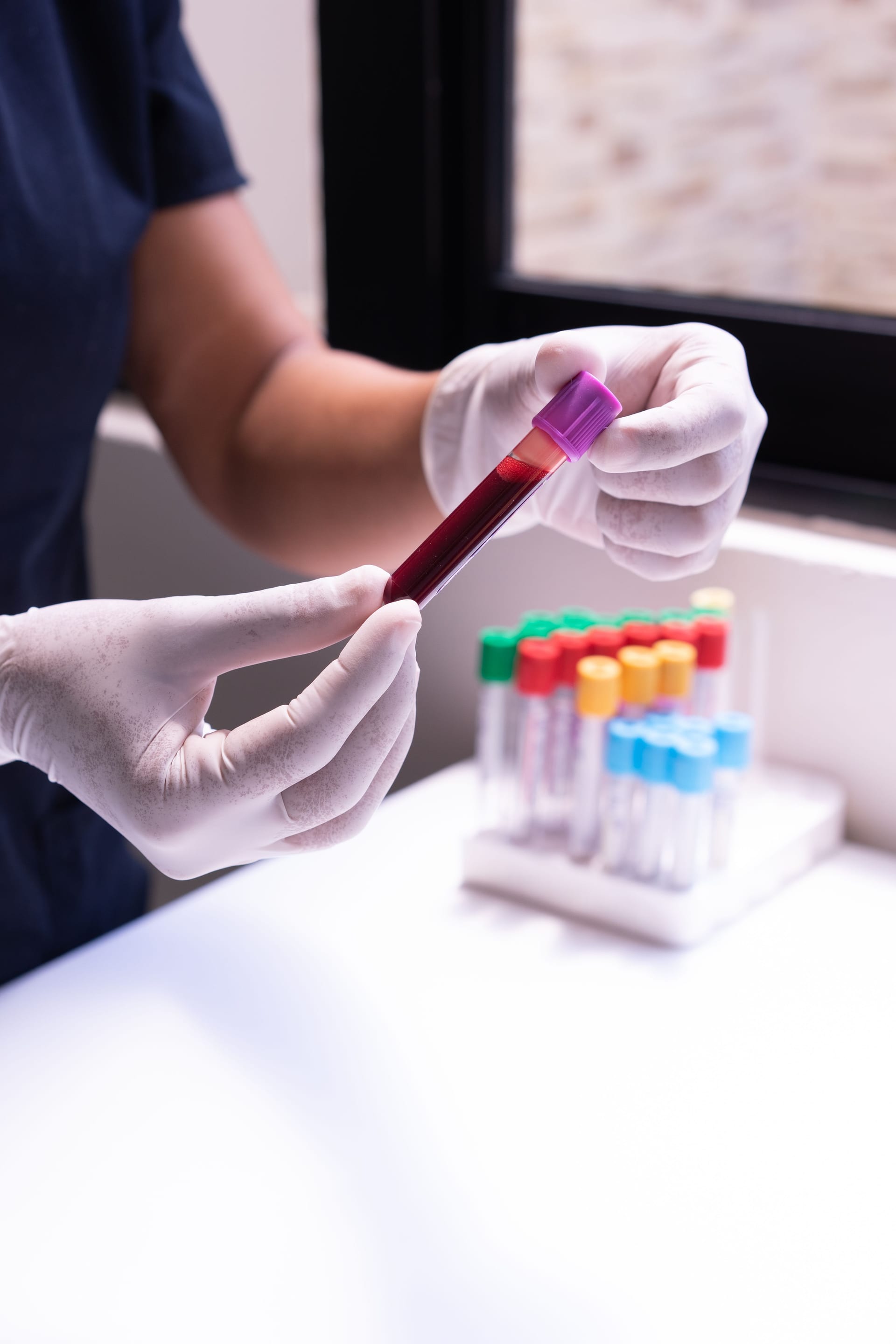 Una persona con guantes de látex sostiene un tubo de ensayo con una muestra de sangre.